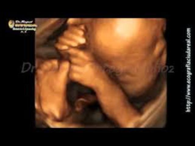 Semana trigecimo septoma de gestación