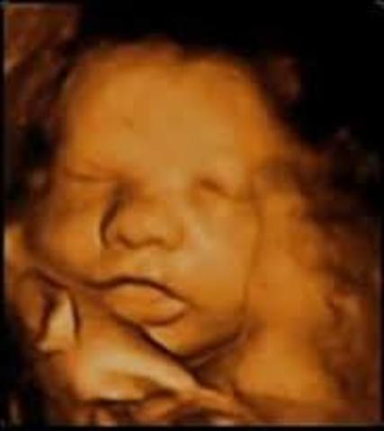 Semana trigecimo ctava de gestación