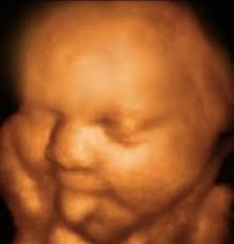 Semana trigecimo novena de gestación