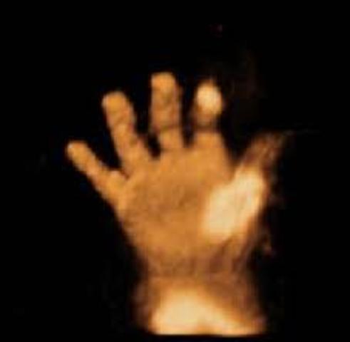 Semana cuarenta de gestación