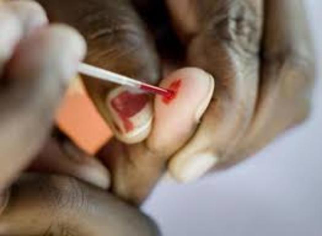 AIDS Blood Test