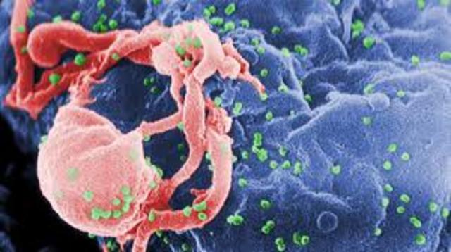 HIV discovered