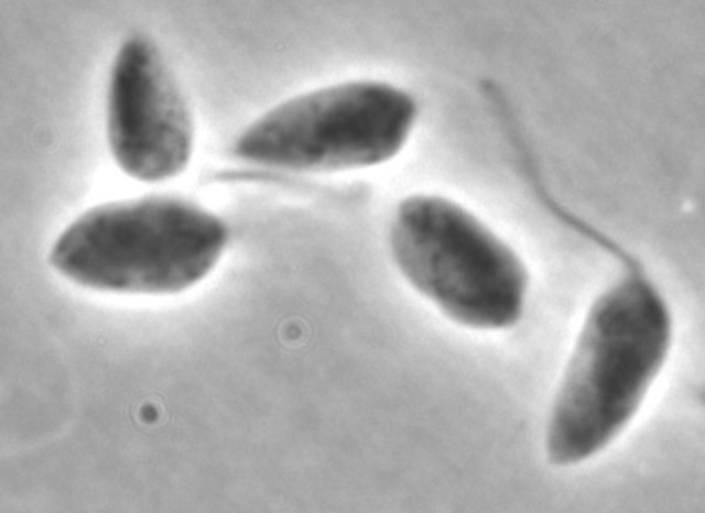 Leishmania braziliensis MHOM/BR/75/M2904
