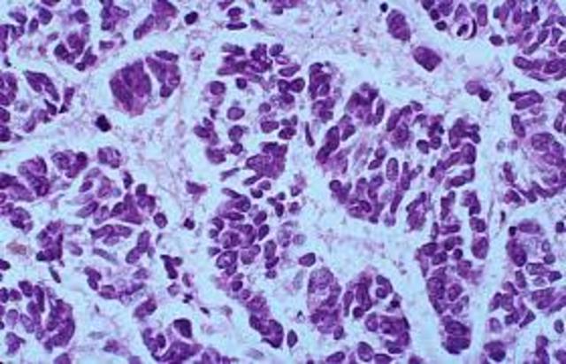 Baba is diagnosed with cancer and Amir marries Soraya