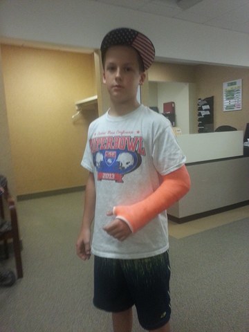 Mi hermano rompió su muñeca.