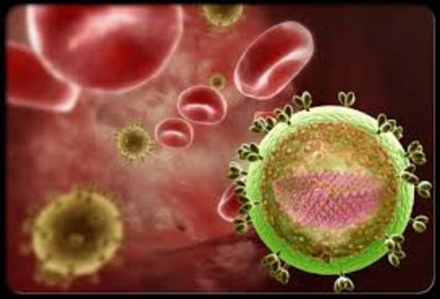 hiv/aids