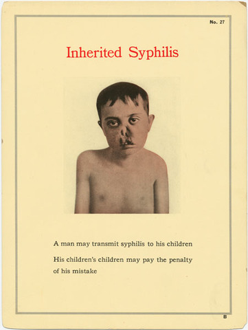 American Social Heath Association (ASHA)