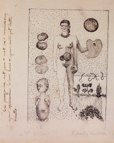 Frida y el aborto o "El aborto"