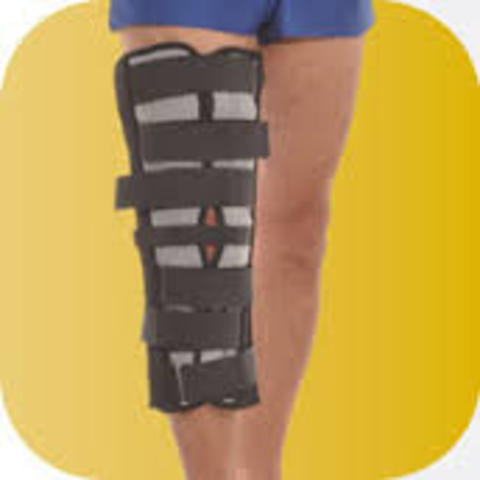 Esguince rodilla izquierda