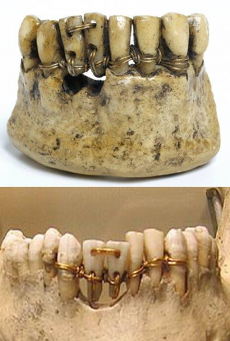 Characteristic of the original device.