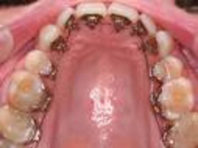 Features of the latest model