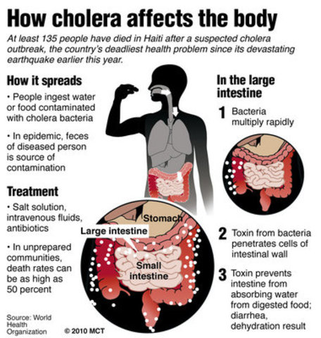 Cholera spreads