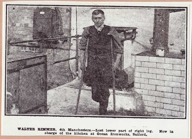 Xavier loses his leg