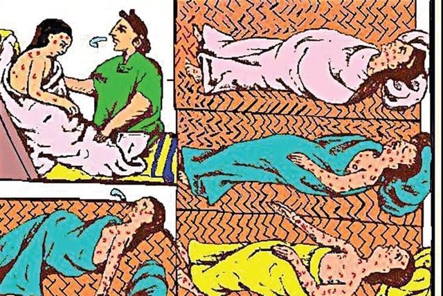 Primera gran epidemia de viruela