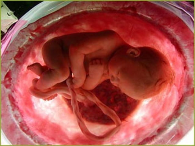 OCTAVO MES DE EMBARAZO