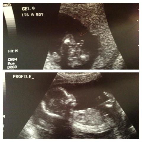 Oh Baby! (biosocial/ psychosocial)