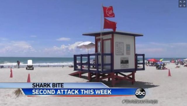 13-year girl bit on foot at Ocean isle Beach, NC