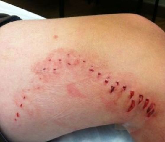 12-year-old Utah boy was bitten by a shark while swimming at the Isle of Palms County Park near Charleston, SC