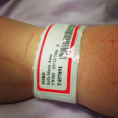 Had my appendix removed