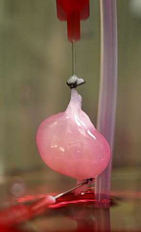 se utiliza por primera vez un riñón artificial para la diálisis