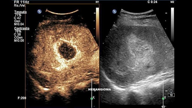 Nuevo escáner para detectar cán