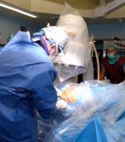 Primera cirugia laser