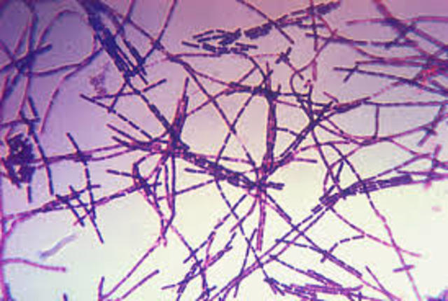 DESCUBRIMIENTO DEL VIRUS BACILLUS ANTHRACIS "Ántrax"