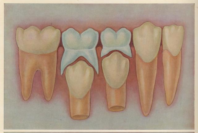 RECAMBIO DE TEMPORARIOS POR PERMANENTES