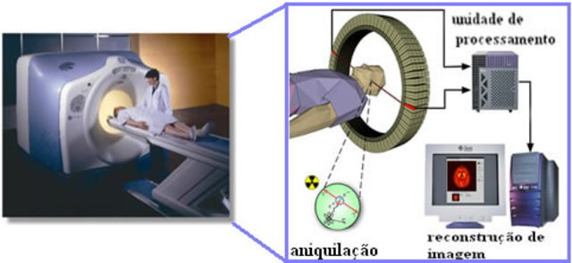 Tomografía por emisión de positrones