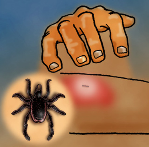 Primera vacuna para la enfermedad de Lyme