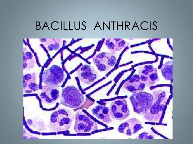 Bacillus anthracis