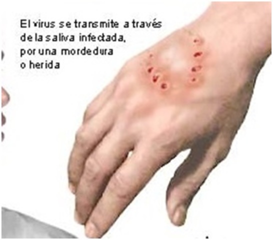 VACUNA CONTRA LA RABIA