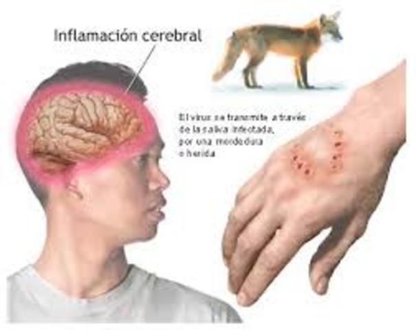 Primera vacunación contra rabia,Louis Pasteur