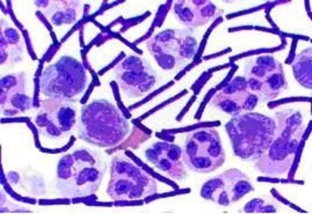 Desarrollo de la tinción de Gram.