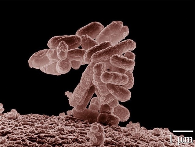Escherichia coli.