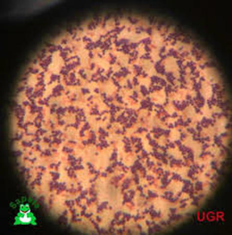 TINCION GRAM EN BACTERIAS