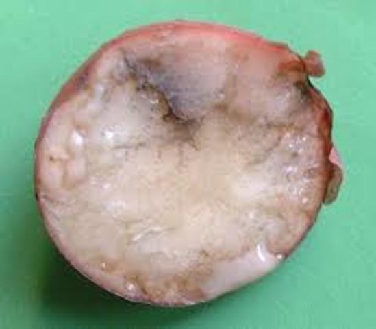 Miles Joseph Berkeley