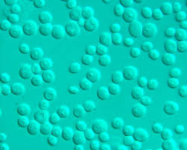 hongo Saccharomyces cerevisiae.