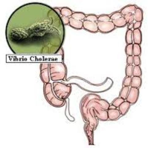 PRIMER ESTUDIO EPIDEMIOLOGICO DE  LA COLERA