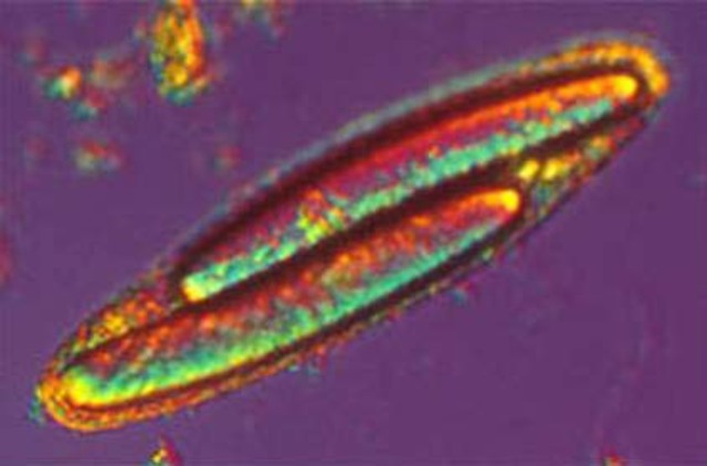 La mayor célula procariota.