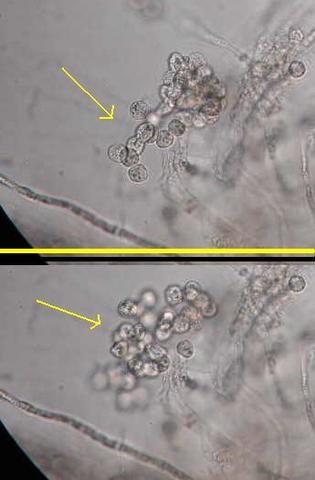 hongo (Phytophthora infestans) que produce la podredumbre de la patata.