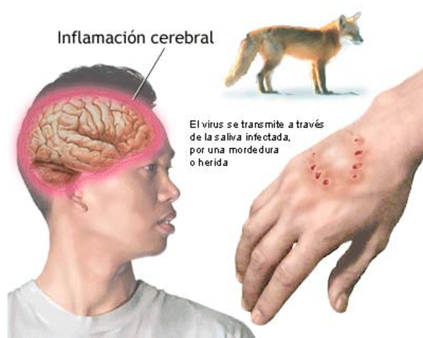 Louis Pasteur puso a punto una vacuna contra la rabia.