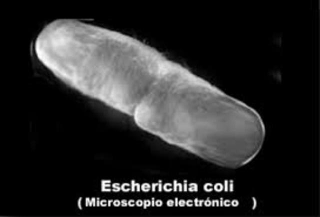 Escherich descubre Escherichia coli.
