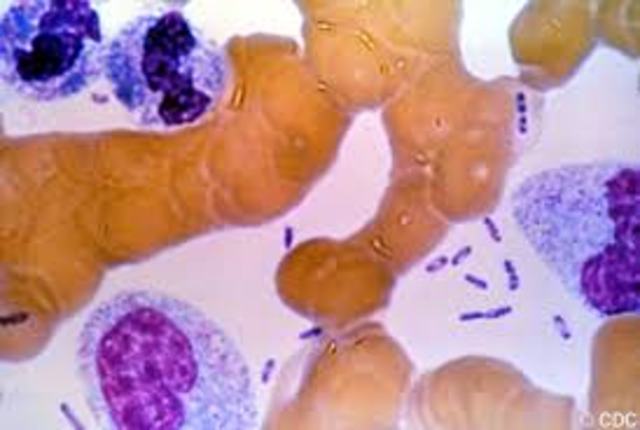 bacteria Yersinia pestis causante de la peste. Shibasaburo K