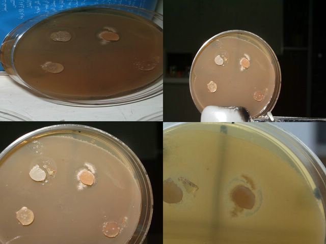 Aisla estreptomicina de un cultivo de Streptomyces. Albert Schatz