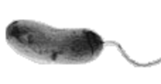 Primer estudio epidemiológico del cólera en Londres.