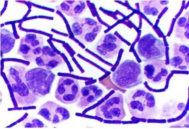 Descubierto método para la tinción del bacilo de la tuberculosis