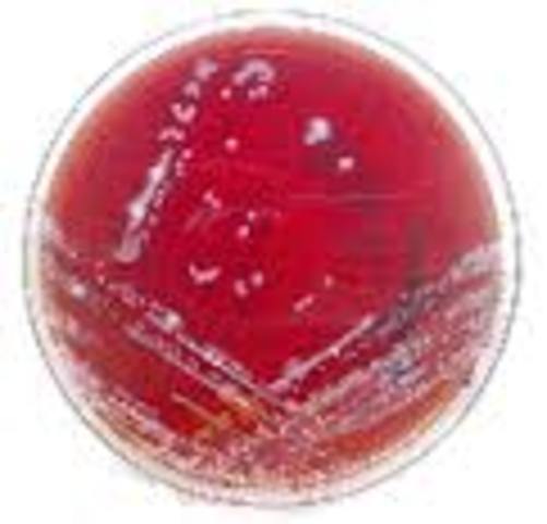 Introducción de los indicadores de PH en los medios de cultivo