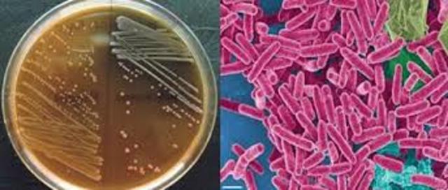 Aislamiento Bacterias Lacticas