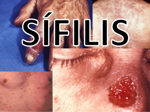 VON WASSERMANN, AUGUST